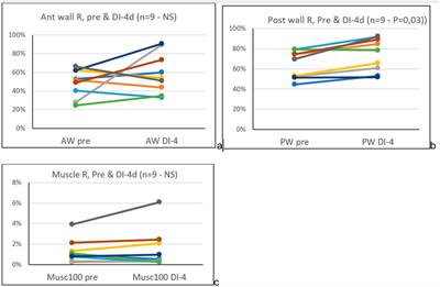 4 days in dry immersion increases arterial wall response to ultrasound wave as measured using radio-frequency signal, comparison with spaceflight data